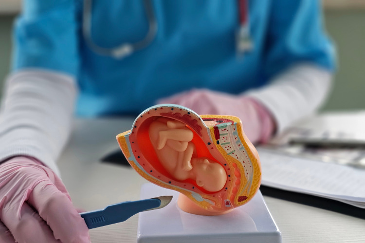 abortion