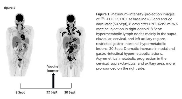 lymphoma after covid booster