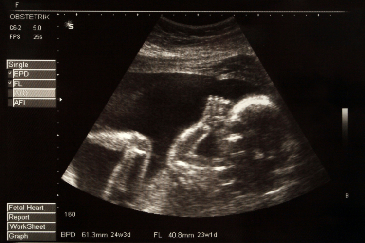 NSW Abortion Greens Bill Adobe