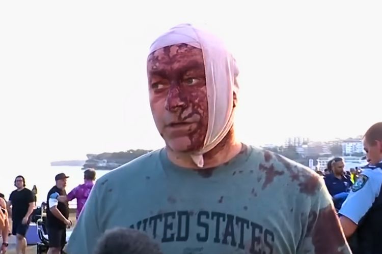 After Bondi Beach, the West Must Directly Confront Jihadism