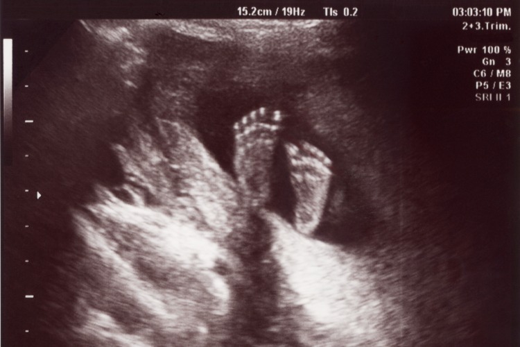 Day 13 What We have Always Known