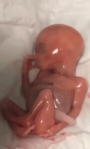 Baby Samuel