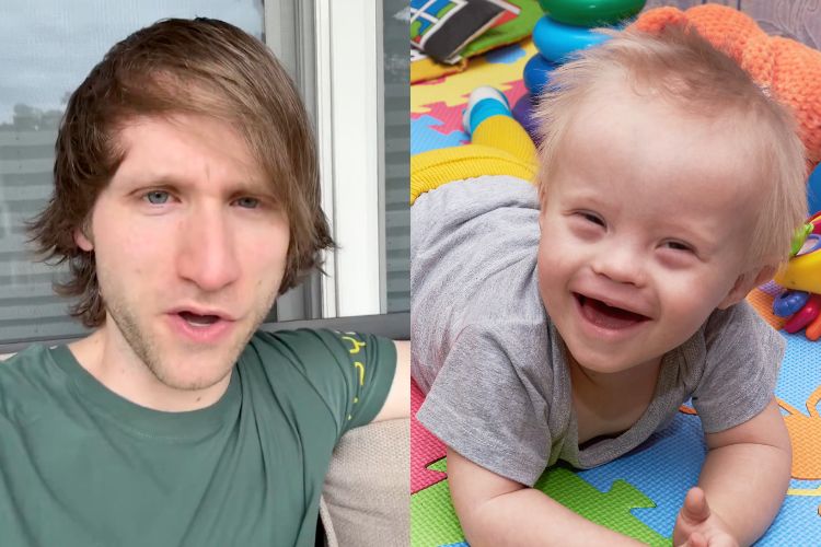 Down Syndrome Children