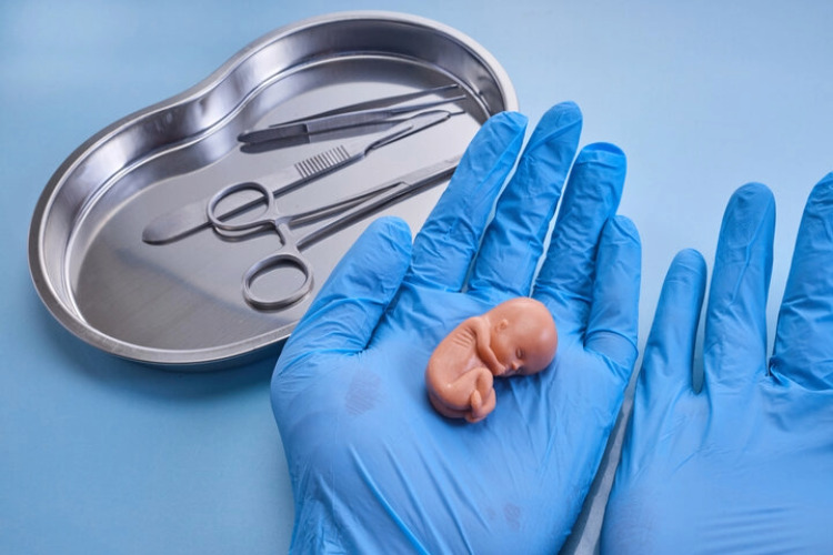 New Release: Queensland's Abortion Statistics