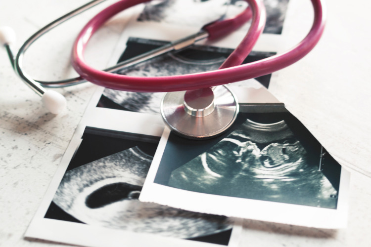 Getting the Abortion Debate Right